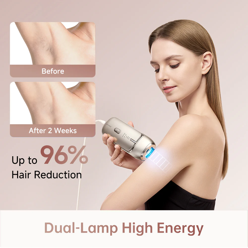 Dreame Nova IPL Hair Removal Device - Image 4